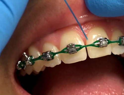 Dental Floss for Braces